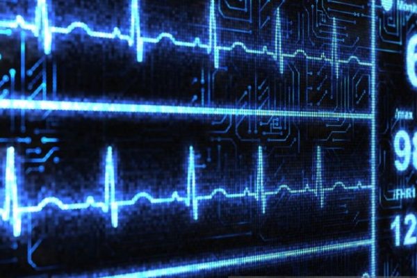 Cardiac Monitor Cardiac Monitor